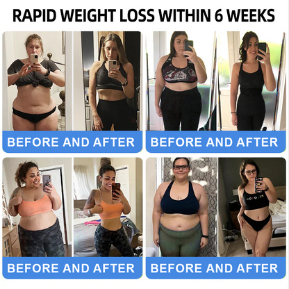 𝑪𝒗𝒓𝒆𝒐𝒛®Enjoy 40% OFF for adding the second one!🔥