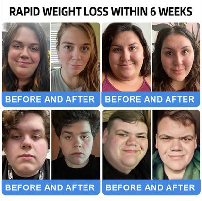 𝑪𝒗𝒓𝒆𝒐𝒛®Enjoy 40% OFF for adding the second one!🔥