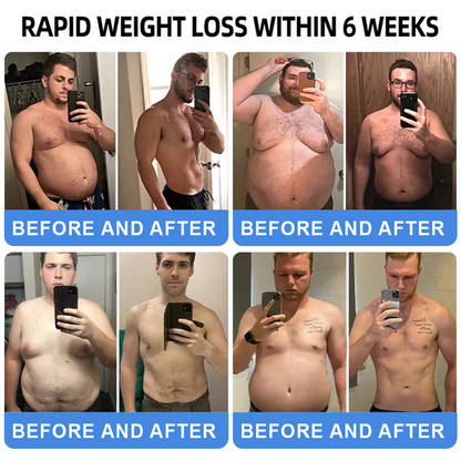 𝑪𝒗𝒓𝒆𝒐𝒛®Enjoy 40% OFF for adding the second one!🔥